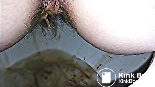 diarrhea