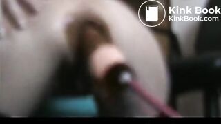 granny anal fuck machine - shit everywhere !!!!!