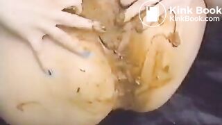 shit vagina