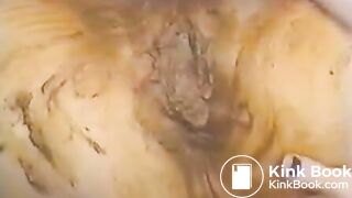shit vagina