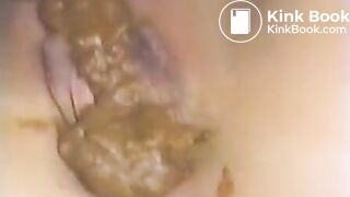 shit vagina