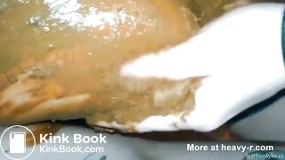 Scheiss Blasen - super