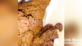 Black girl's unusual poop