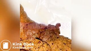 Black girl's unusual poop