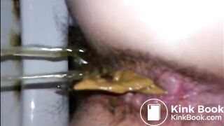Hairy woman shitting a lot of diarrhea closeup