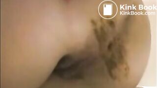 Milf is showing her pulsating asshole with shit