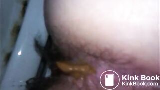 Hairy woman shitting very closeup
