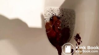 Huge poop viewed close up