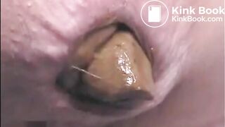 Girl shitting a very big turd closeup