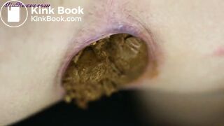 The closest of closeup poops