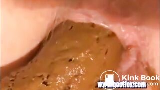 15 days without shitting