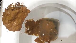 massive diarrhea attack