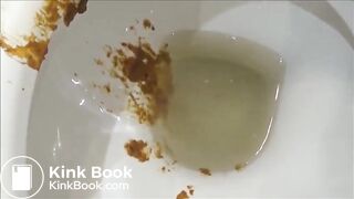 massive diarrhea attack