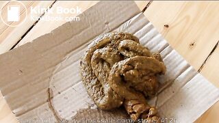 Huge ballet injury poop