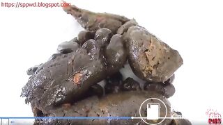 Two struggle to poop constipated