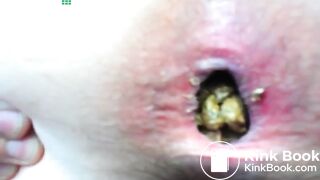 massive shit from girl asshole