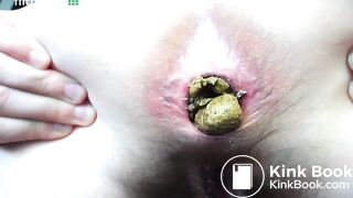 massive shit from girl asshole