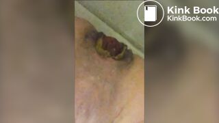 Shitting with prolapse - ThisVidcom