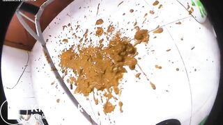 OMG Diarrhea explosion so yum