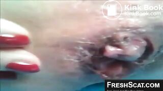 Woman  Fucks With Ruined Asshole And Pussy