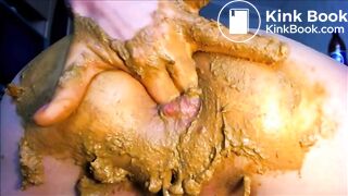 Girl shitting diarrea fisting asshole and prolapse