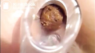 Crazy milf in lingerie put speculum in her ass and shitting