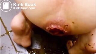 Prolapsed anus girl diarrhea explosion when buttplug go out