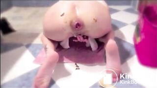 Lesbian girl prolapsed asshole plug fart and shit