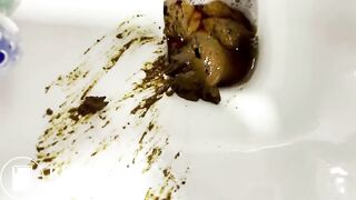 A very impressive poop and pussy gape