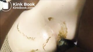Interracial anal fucking with shit