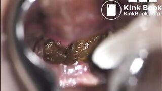 inside asshole while pooping n farting