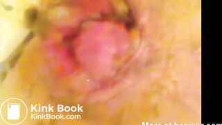 Scheisse raus Scheisse rein