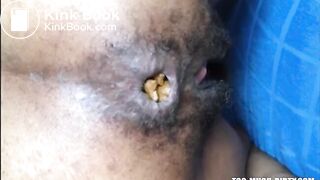 Hairy asshole latina shitting closeup