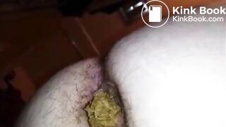 Hairy butt woman shitting a big quantity closeup