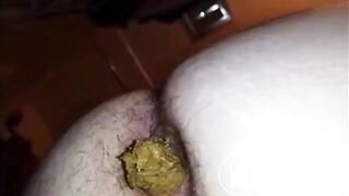 Hairy butt woman shitting a big quantity closeup