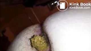 Hairy butt woman shitting a big quantity closeup