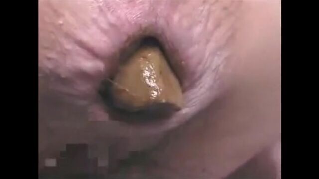 This woman is shitting a huge turd closeup