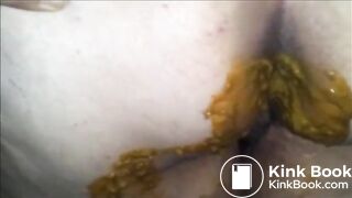 Big cellulitic butt mature woman shitting diarrhea