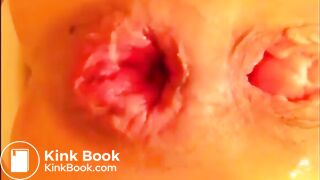 Anal self fisting prolapsed with little shit