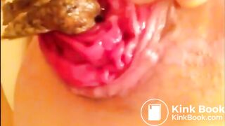Anal self fisting prolapsed with little shit