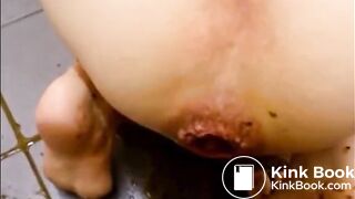 Prolapsed anus woman shitting a big plug and liquid shit