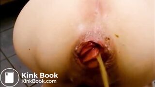 Prolapsed anus woman shitting a big plug and liquid shit