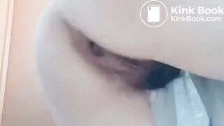 Poop on my hand