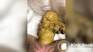 Me shitting on diaper