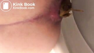 Another huge poop (June 2018)