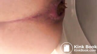 Another huge poop (June 2018)