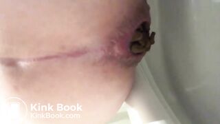 Toilet poop (Febuary 2019)