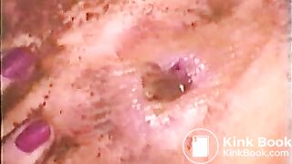 Peirced Poop Play - Low Quality