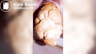 rectum à vider