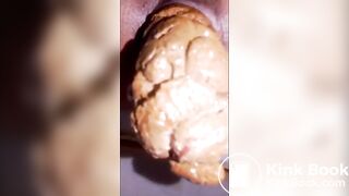 rectum à vider